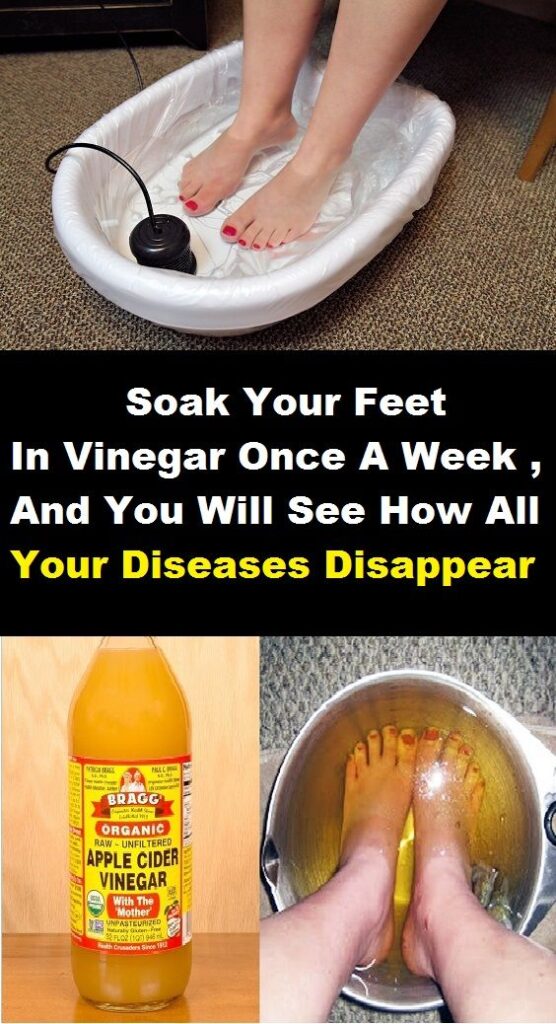 Soak Your Feet in Vinegar Once a Week and You Will See How All Your